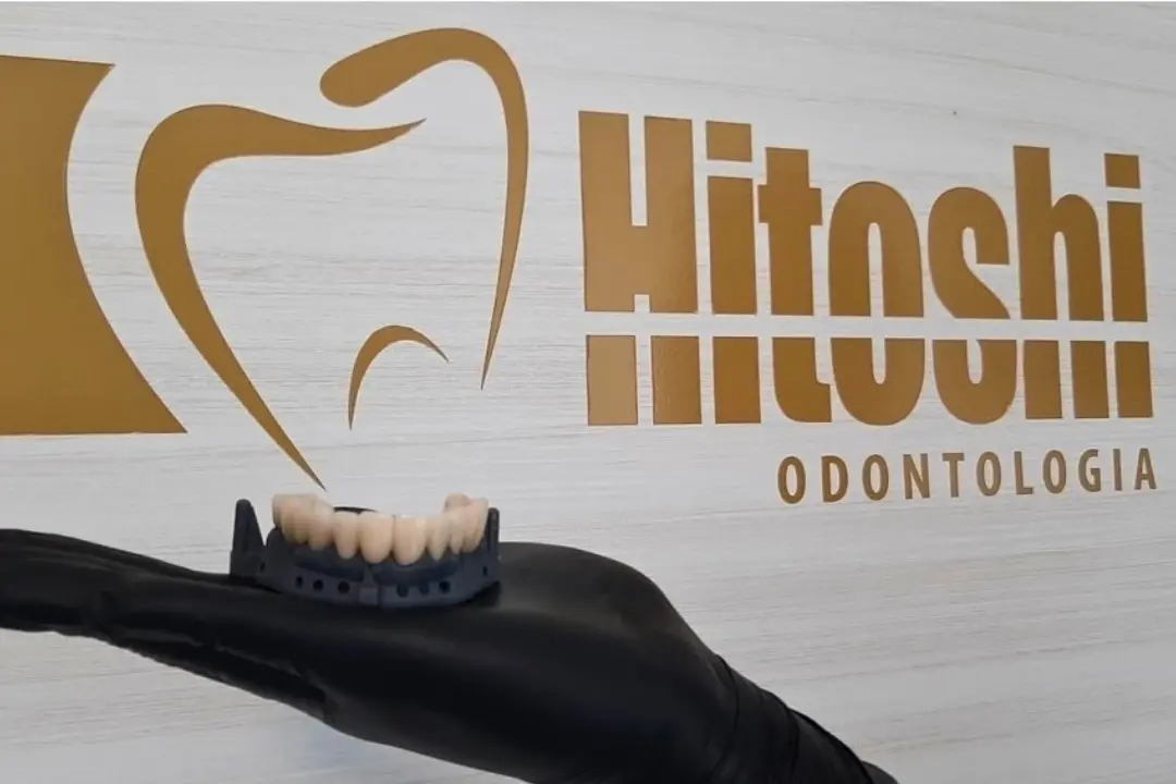 Mão com luva preta segurando um modelo de prótese sobre implantes dentários, com a logomarca da Hitoshi Odontologia ao fundo na parede.